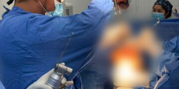Realiza IMSS Chiapas 10 reemplazos de rodilla en Jornada de Cirugía Especializada